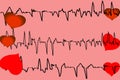 Tracing of the cardiogram with heart