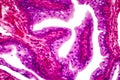 Transitional epithelium tissue