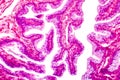 Transitional epithelium tissue