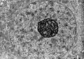 Cell nucleus. TEM Royalty Free Stock Photo