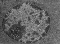 Nucleus and nucleolus, TEM