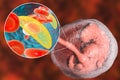 Transmission of Toxoplasma gondii parasites to fetus, medical concept