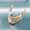 Transparent aligner orthodontic device above teeth cast