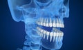 Transparent scull and teeth , xray view