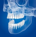 Transparent scull and teeth , xray view