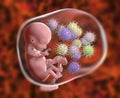 Transplacental transmission of Cytomegalovirus to human embryo