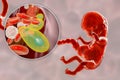 Transplacental transmission of Toxoplasma gondii parasites to human embryo