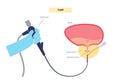 Transurethral resection of the prostate