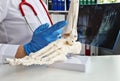Trauma surgeon evaluates x-rays of legs closeup