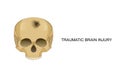 Traumatic brain injury