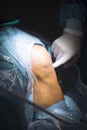 Traumatology orthopedic surgery knee arthroscopy