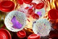 Treatment of acute lymphoblastic leukemia Royalty Free Stock Photo