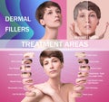 Treatment areas for anti-wrinkle injection Royalty Free Stock Photo