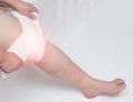 Treatment of arthritis of the knee and inflammation with a medical compress, tight bandage, close-up, copy space, synovitis