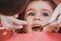 Treatment of baby teeth in a child, a little girl at the dentist, examination and treatment of teeth. Royalty Free Stock Photo