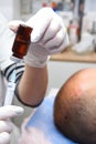 Treatment of baldness with beauty injections. Mesotherapy. Plasmalifting. Royalty Free Stock Photo