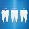 Treatment Of Caries. Dental Filling Isolated On A Background. Vector Illustration.