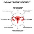 Treatment of endometriosis. Adenomyosis. The structure of the pelvic organs with endometriosis. Infographics. Vector Royalty Free Stock Photo