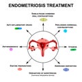 Treatment of endometriosis. Adenomyosis. The structure of the pelvic organs with endometriosis. Infographics. Vector