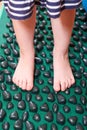 Treatment of flatfoot with massage mat