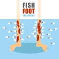 Treatment foot fish. Medical procedure for treatment of psoriasis and skin diseases. Small fish eat painful human skin. Lower