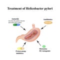 Treatment of Helicobacter pylori. Medications. Antacids, proton pump blockers and H2-histamine blockers. Infographics