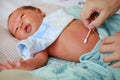 Treatment of newborn baby navel with a cotton swab