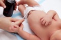 Treatment of newborn baby navel with cotton swab