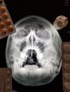 Medical pills and x-ray of the human head Royalty Free Stock Photo