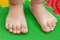 Treatment and prevention of flat feet in children. A small child walks barefoot on an orthopedic mat puzzle.