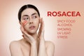 Treatment of rosacea. Portrait of a young, beautiful woman fighting with her hands over her face. There is an enlarged