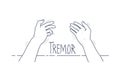 Tremor hands. First-person view of shaking hands. Symptom of Parkinson`s disease. Medical vector illustration