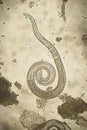 Trichinella spiralis - parasitic nematoda worm microscope Royalty Free Stock Photo