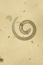 Trichinella spiralis - parasitic nematoda worm microscope Royalty Free Stock Photo