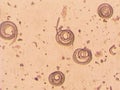 Trichinella spiralis - parasitic worm microscope Royalty Free Stock Photo