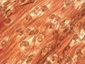 Trichinella spiralis - parasitic worm microscope Royalty Free Stock Photo