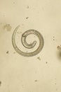 Trichinella spiralis - parasitic nematoda worm microscope Royalty Free Stock Photo