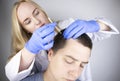 A trichologist doctor drips the serum onto the patient`s hair. Treatment of alopecia. Hair loss, alopecia, pruritus, burning head