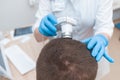 Trichoscopy of a man`s head in a beauty parlor Royalty Free Stock Photo