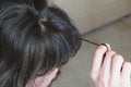 Trichotillomania, human impulse behavioral problem,hair pulling disorder Royalty Free Stock Photo