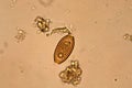 Trichuris trichiura Royalty Free Stock Photo