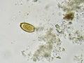 Trichuris trichiura