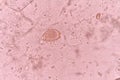 Trichuris trichiura Royalty Free Stock Photo