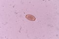 Trichuris trichiura Royalty Free Stock Photo