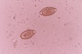 Trichuris trichiura Royalty Free Stock Photo