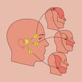 The trigeminal nerve