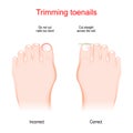 Trimming toenails. Incorrect and Correct