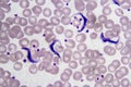 Trypanosoma gambiense blood smear Royalty Free Stock Photo