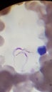 Trypanosoma rhodesiense seen in blood - Sleeping Sickness