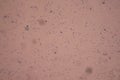 Tuberculosis bacteria under the microscop Royalty Free Stock Photo